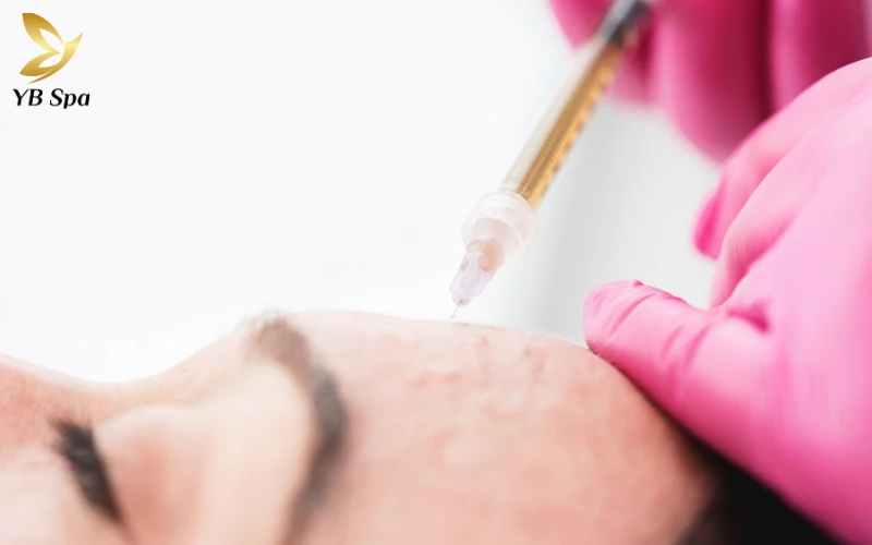 Mesotherapy thực chất là một kỹ thuật dẫn truyền chuyên sâu, sử dụng kim siêu nhỏ để đưa trực tiếp hoạt chất vào tầng trung bì của da