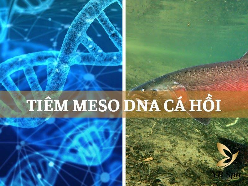 tiem meso dna ca hoi
