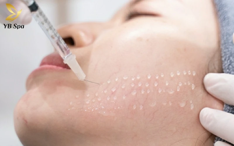 Tái cấu trúc và cải thiện độ đàn hồi