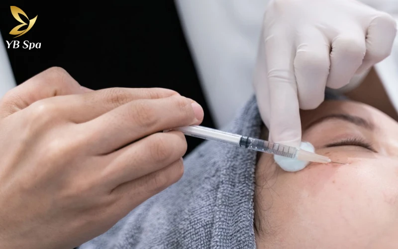 Tiêm Meso trị mụn có hiệu quả không? 5 Lưu ý sau tiêm để đạt hiệu quả tốt nhất 25 Lựa chọn Meso giúp bạn vừa tiết kiệm thời gian điều trị, vừa an tâm về khả năng phòng ngừa các biến chứng sẹo rỗ khó phục hồi