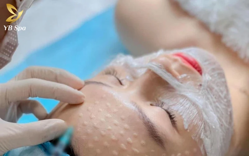 Tình trạng mụn và mức độ tổn thương da