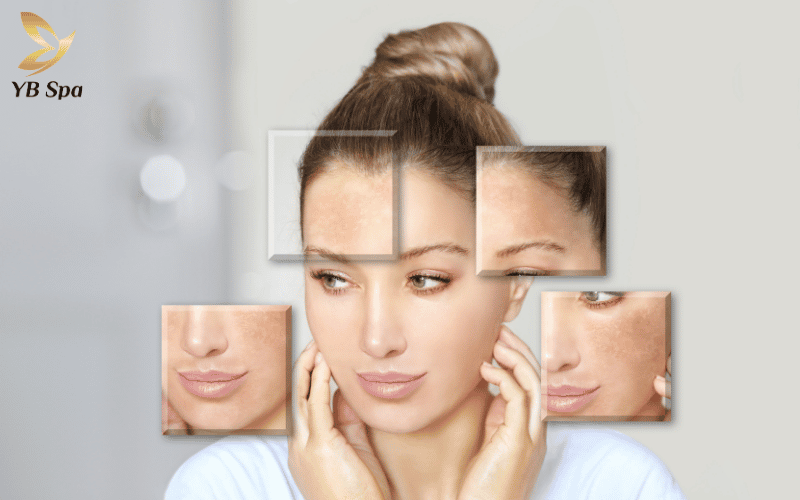 Meso là sự lựa chọn hàng đầu để cải thiện tông da và loại bỏ các vết thâm nám mất thẩm mỹ