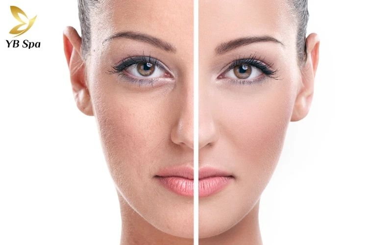 Cách làm trắng da mặt nhanh nhất trong 1 tuần 9 Bật mí cách làm trắng da mặt nhanh nhất trong 1 tuần giúp loại bỏ vẻ xỉn màu và tối ưu hóa độ sáng tự nhiên cho da