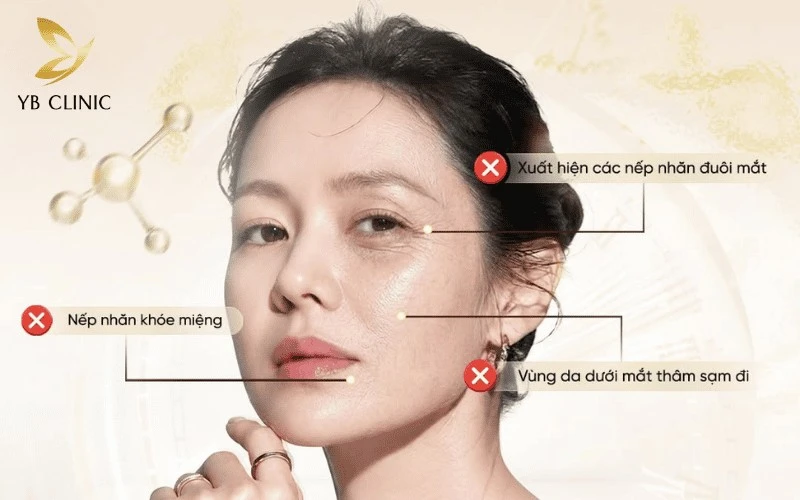 4 Phương Pháp Trẻ Hóa Da Tuổi 30 Tại Nhà 10 Các nếp nhăn tĩnh và rãnh cười bắt đầu xuất hiện rõ nét ở phụ nữ tuổi 30.