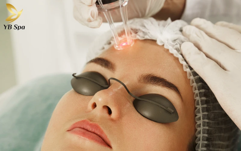 Trị mụn bằng Laser: Cơ chế hoạt động, phân loại và lợi ích 21 Trị mụn bằng laser