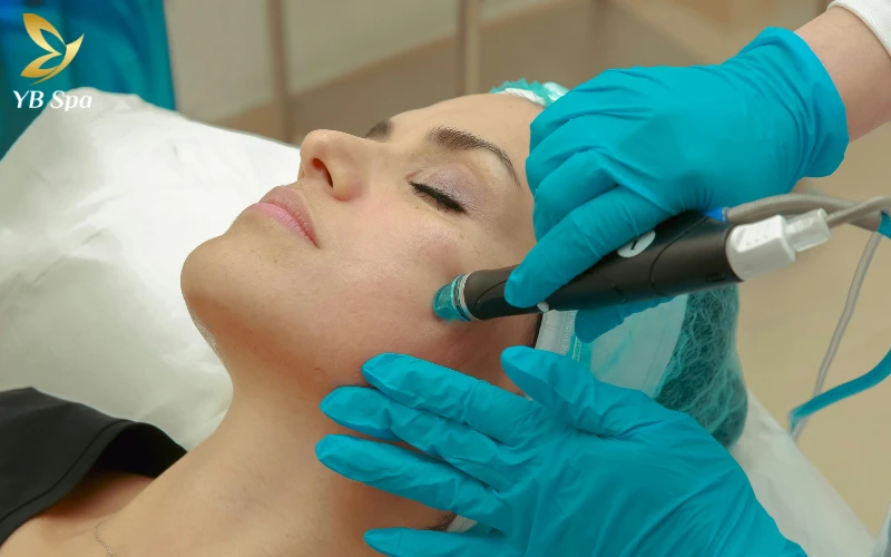 Trị mụn bằng Laser: Cơ chế hoạt động, phân loại và lợi ích 26 Xâm lấn tối thiểu, ít đau đớn