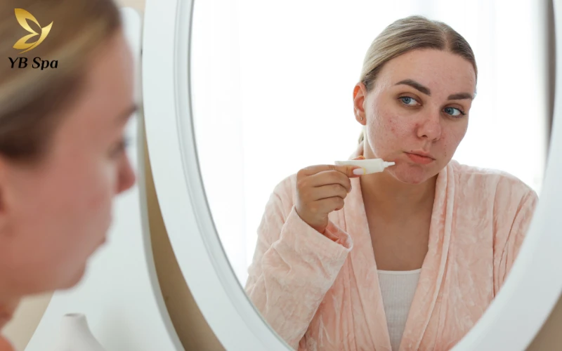 Trị mụn cấp tốc sau 1 đêm có khả thi không?