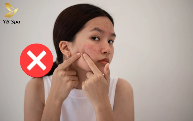 Tự ý nặn mụn tại nhà