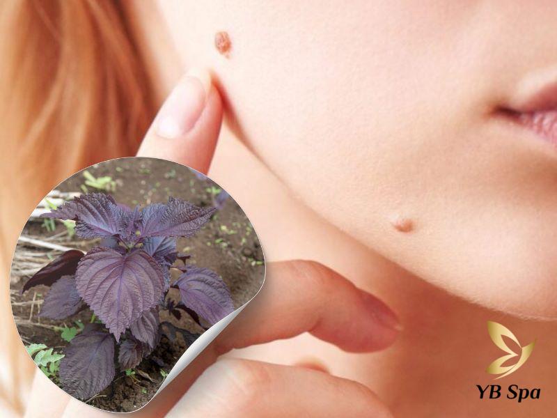 trị mụn cóc bằng lá tía tô
