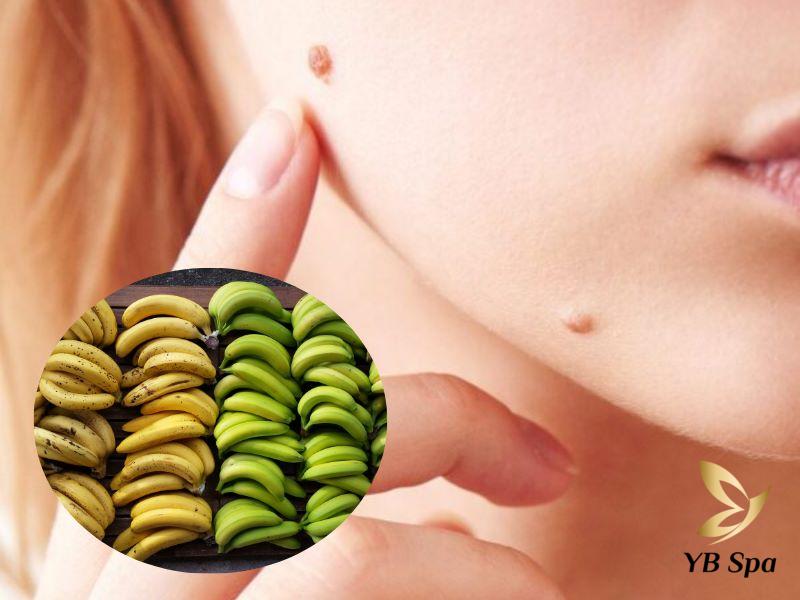 Cách trị mụn cóc bằng vỏ chuối chín và xanh hiệu quả tại nhà