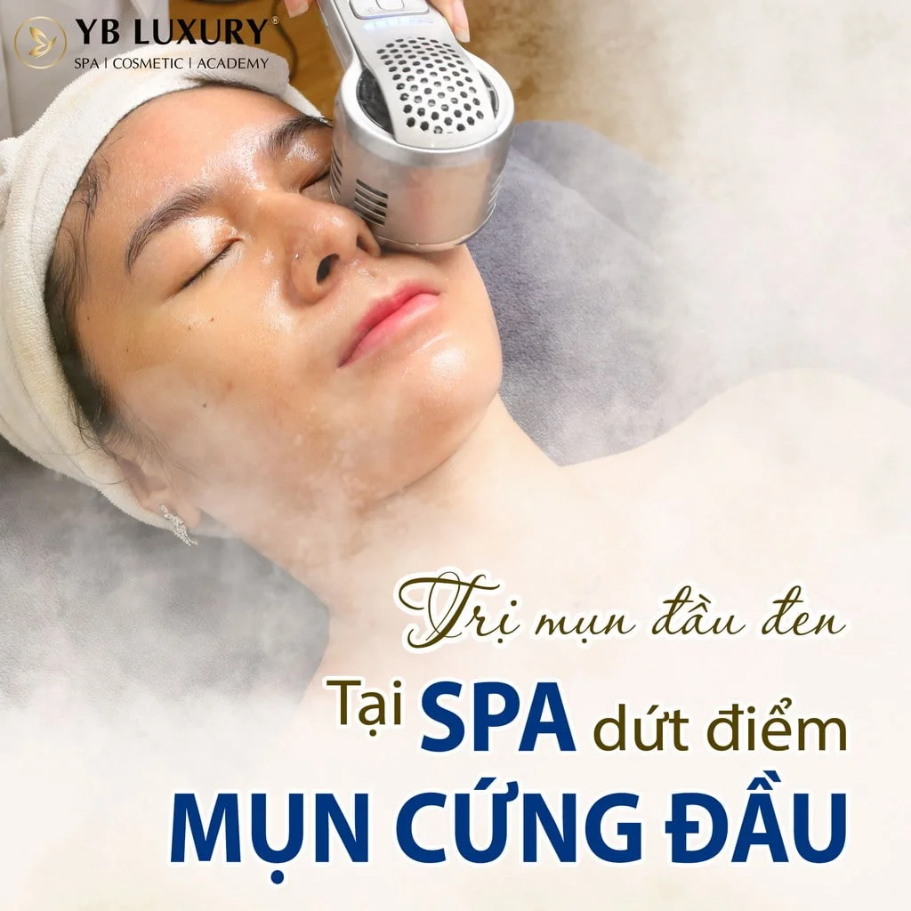 Trị Mụn Đầu Đen Spa - Phương Pháp Hiệu Quả, An Toàn Tại Spa