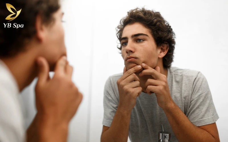 Cẩm nang trị mụn viêm đỏ an toàn, hiệu quả từ chuyên gia 36 Tự ý nặn mụn viêm đỏ tại nhà