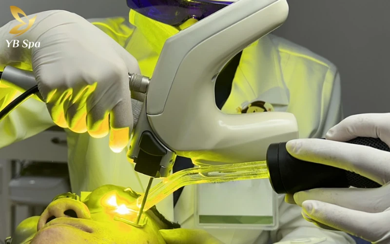 Laser Pulsed Dye (PDL)