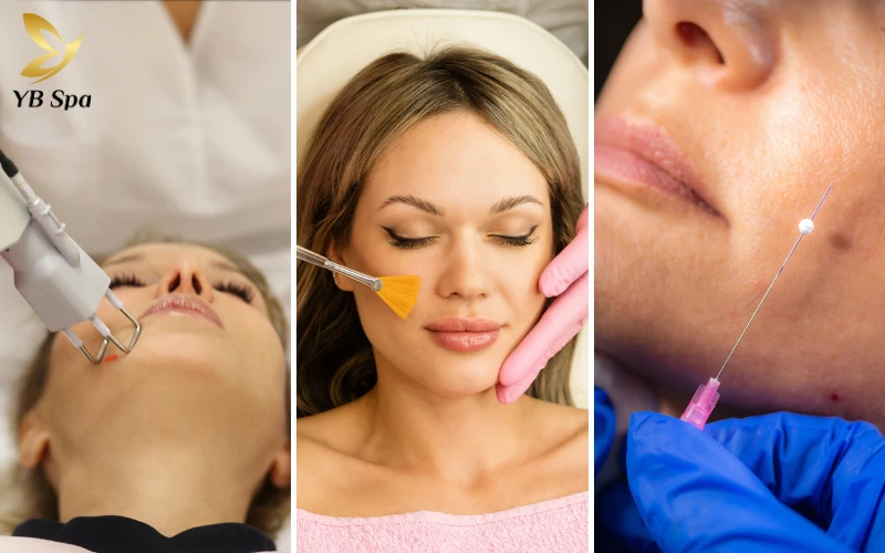 Trị sẹo rỗ bao nhiêu tiền? Bảng giá cập nhật 2026 20 Các yếu tố ảnh hưởng đến giá trị sẹo rỗ