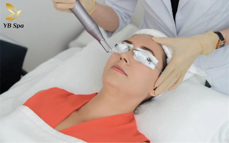 Laser Q-switched (Nano/Pico Giây)