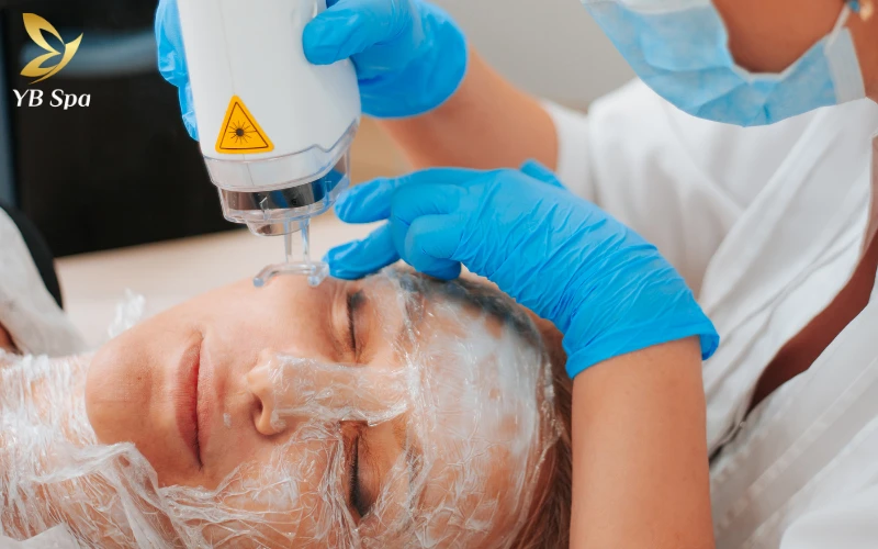 Laser Fraxel (Fractional Laser)