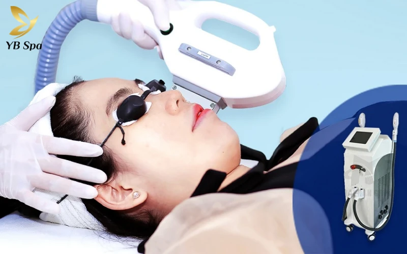 IPL (Intense Pulsed Light)