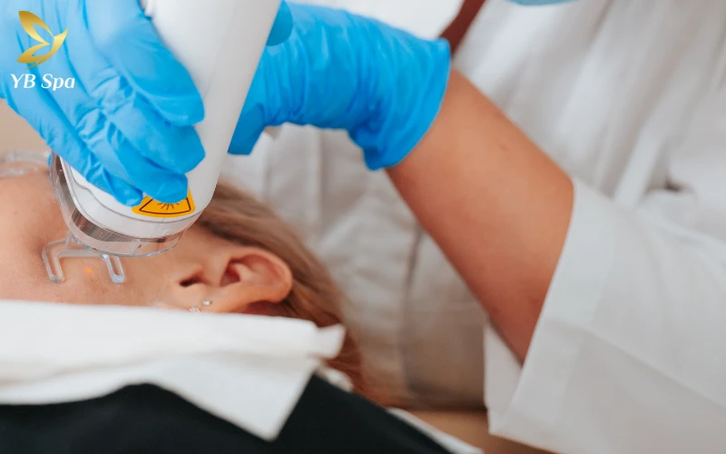 điều trị tăng sắc tố sau mụn bằng Công nghệ Laser Fractional