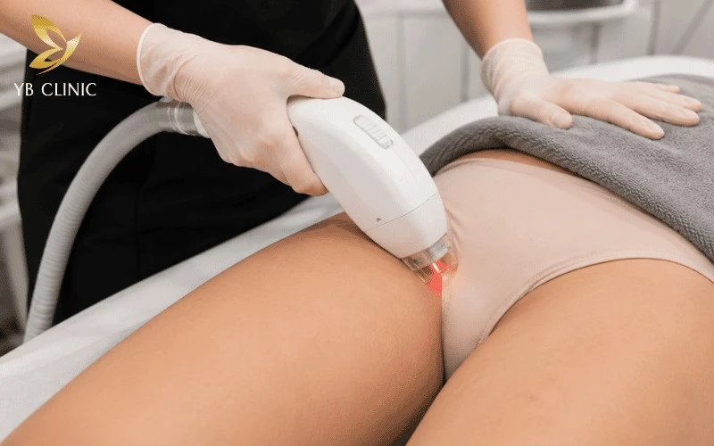 Trị Thâm Bẹn Có Đau Không? Mức Độ Đau Và Yếu Tố Ảnh Hưởng 7 Trị thâm bẹn bằng công nghệ hiện đại chỉ gây cảm giác châm chích hoặc nóng nhẹ tạm thời, không gây đau đớn dữ dội trong quá trình thực hiện.