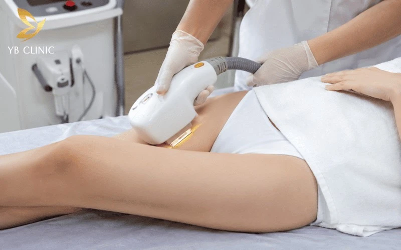 Trị Thâm Bẹn Công Nghệ Cao Có Hiệu Quả Không? Công Nghệ Và Chi Phí 12 Công nghệ ánh sáng sinh học IPL trị thâm bẹn sử dụng xung ánh sáng để giảm melanin, hỗ trợ làm sáng da.