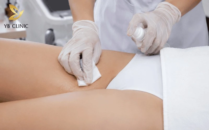Trị Thâm Bẹn Công Nghệ Cao Có Hiệu Quả Không? Công Nghệ Và Chi Phí 14 Kỹ thuật viên tiến hành vệ sinh vùng da bẹn bằng dung dịch vệ sinh y khoa dịu nhẹ để loại bỏ mồ hôi, bã nhờn và tế bào chết tích tụ tại các nếp gấp.