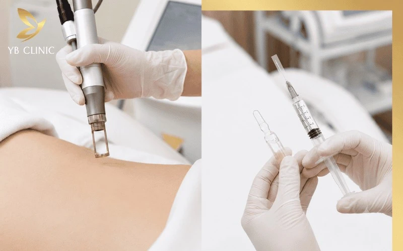 Phác đồ kết hợp Laser và Peel giúp rút ngắn 50% thời gian phục hồi làn da xỉn màu.