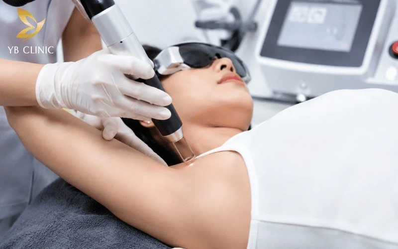 Trị Thâm Nách Có Đau Không? Yếu Tố Ảnh Hưởng Và Cách Giảm Đau 7 Công nghệ Laser Nd:YAG thế hệ mới giúp giảm thiểu cảm giác châm chích khi điều trị.