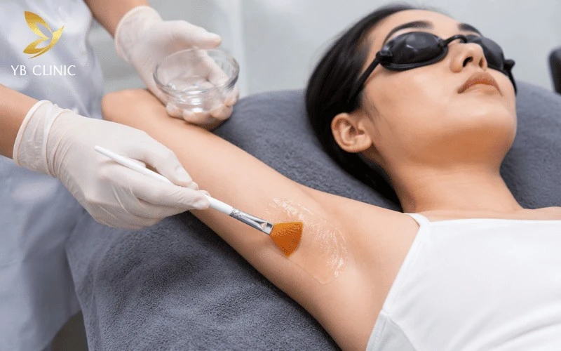 Trị Thâm Nách Có Đau Không? Yếu Tố Ảnh Hưởng Và Cách Giảm Đau 11 Peel da hóa học sử dụng các hoạt chất acid nồng độ an toàn để kích thích quá trình bong tróc lớp sừng chứa hắc sắc tố trên bề mặt.