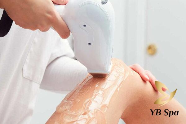 Triệt lông vĩnh viễn phù hợp với những người muốn loại bỏ lông hiệu quả, lâu dài và an toàn (Nguồn: Internet)