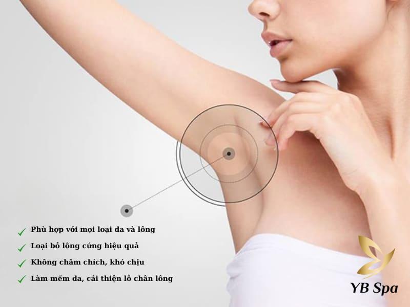 Triệt lông bằng Diode Laser có hại không? 22 Ưu điểm của công nghệ Diode Laser