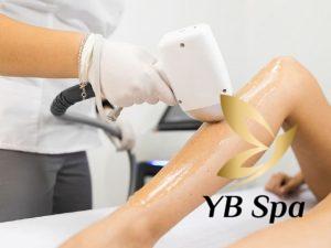 Triệt lông bằng công nghệ Diode Laser