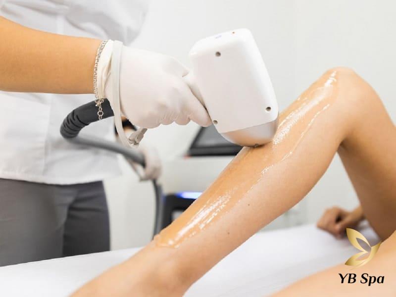 Triệt lông bằng Diode Laser có hại không? 20 Triệt lông bằng công nghệ Diode Laser