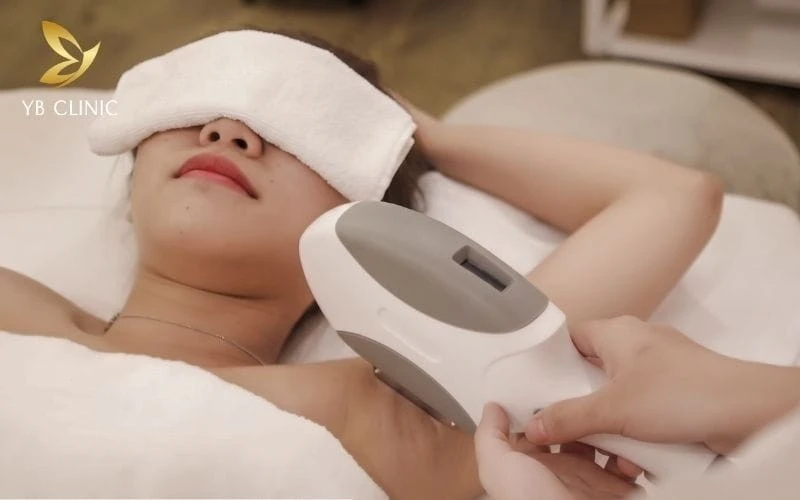 Triệt Lông Bảo Hành Trọn Đời Có Thật Không? Giải Đáp Chi Tiết 2026 8 Chính sách bảo hành tại YB Spa cực kì minh bạch.