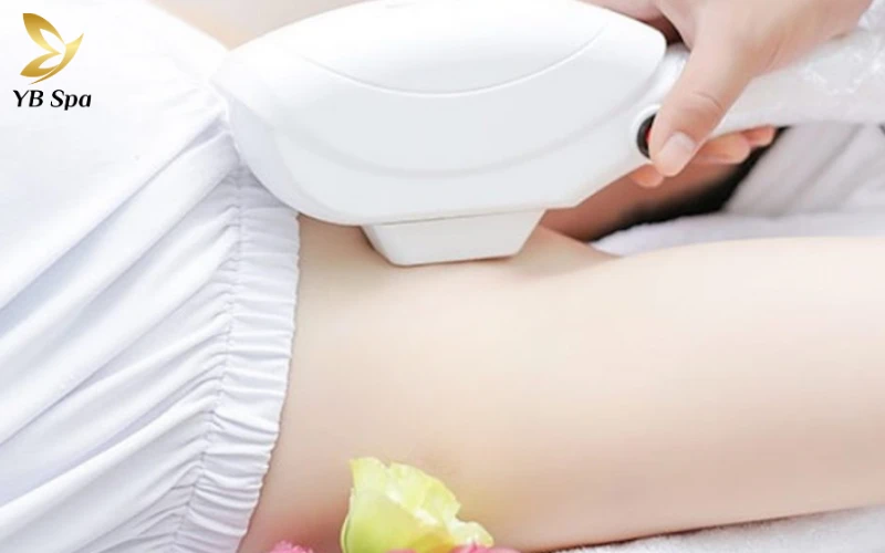 Triệt lông bikini có hại không? 22 Nguyên Lý Triệt Lông Bằng Laser