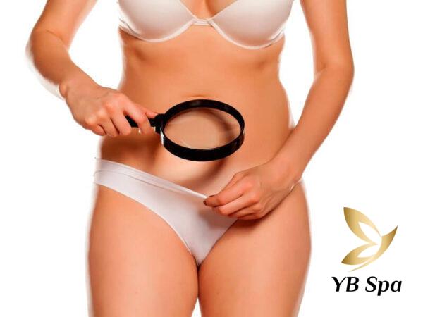 Triệt lông vĩnh viễn là gì? (Nguồn: Internet)