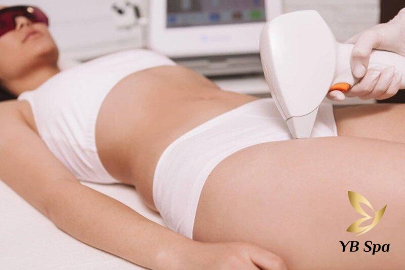 Góc Giải Đáp - Triệt Lông Bikini Mấy Lần Thì Hết? 22 Triệt lông bằng công nghệ Nano Dimond Light