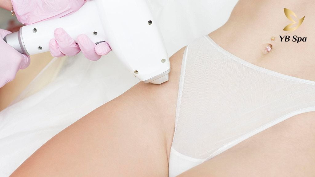 dịch vụ triệt lông 