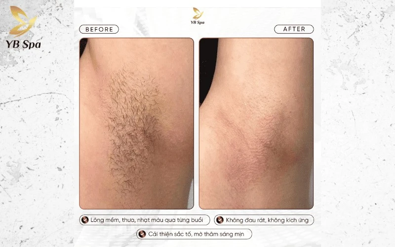 Trải nghiệm cảm giác mát lạnh êm ái trong suốt quá trình đi máy, loại bỏ hoàn toàn nỗi lo đau rát hay châm chích trên da