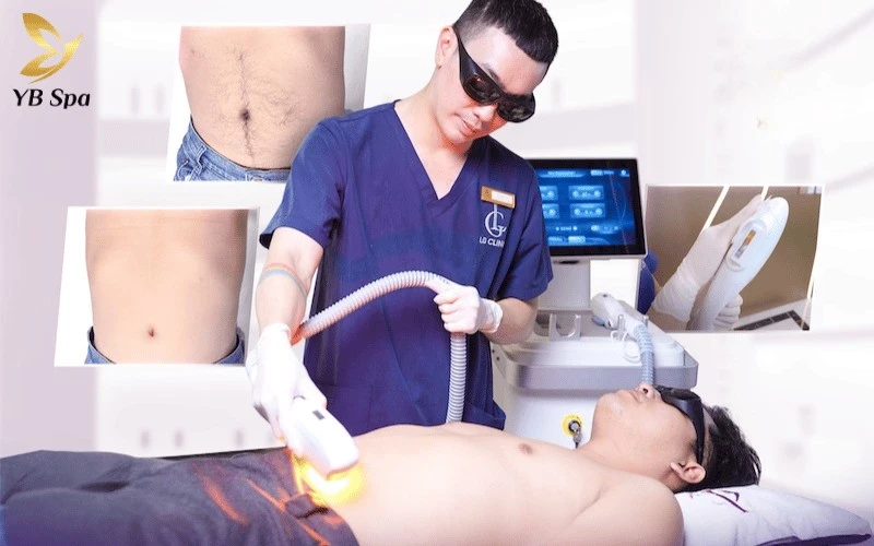 Sự kết hợp giữa máy móc tân tiến và quy trình chuẩn y khoa giúp LG Clinic trở thành địa chỉ triệt lông bụng đáng tin cậy tại TPHCM