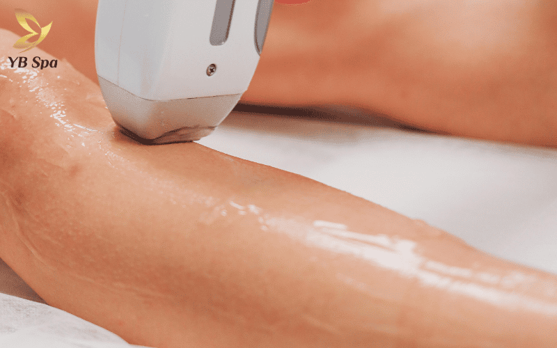 Công nghệ Diode Laser ngăn chặn triệt để nguồn dinh dưỡng nuôi lông, mang lại hiệu quả bền vững và làn da láng mịn