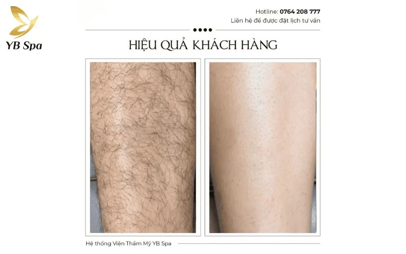 triet long chan tai tphcm 4