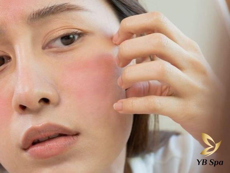 Kem tẩy lông được thiết kế riêng cho da nhạy cảm