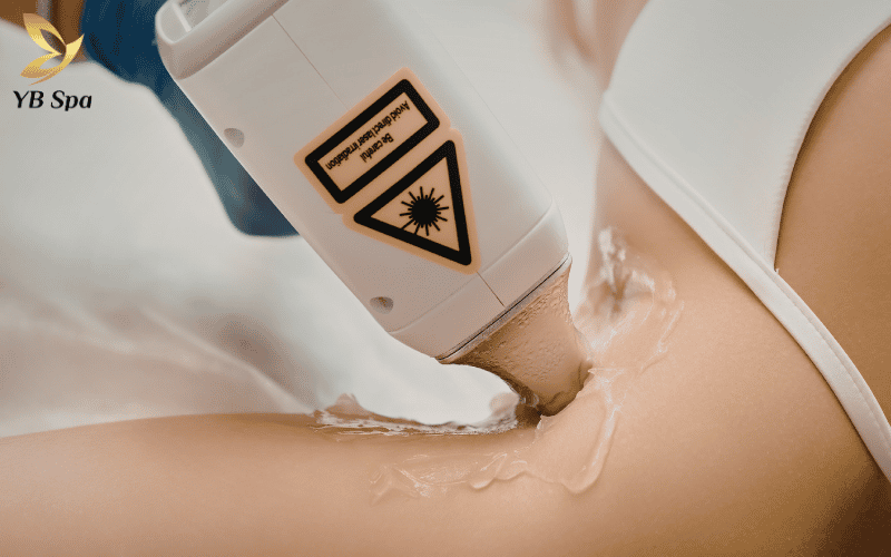 Triệt lông có đau không Đừng để nỗi sợ cản bước, hãy tìm hiểu ngay góc nhìn khoa học về cảm giác khi triệt lông hiện nay