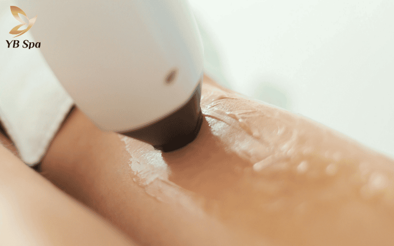 Thay vì đau nhói, bạn sẽ cảm nhận được sự châm chích thoáng qua – dấu hiệu cho thấy nang lông đang được xử lý hiệu quả