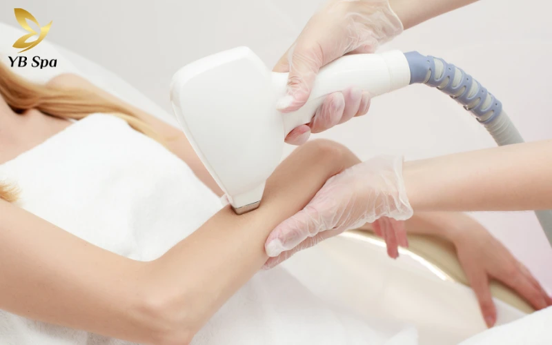 Khám phá ngay 5 lợi ích khi triệt lông để hiểu vì sao đây là quyết định đúng đắn nhất cho sức khỏe làn da