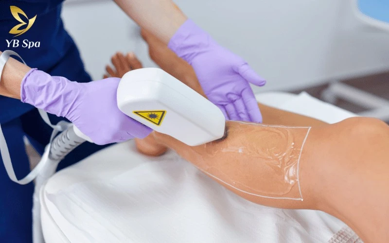 Danh sách các địa chỉ triệt lông Củ Chi hàng đầu, cung cấp thông tin minh bạch về công nghệ và giá cả, hỗ trợ khách hàng đưa ra lựa chọn chính xác