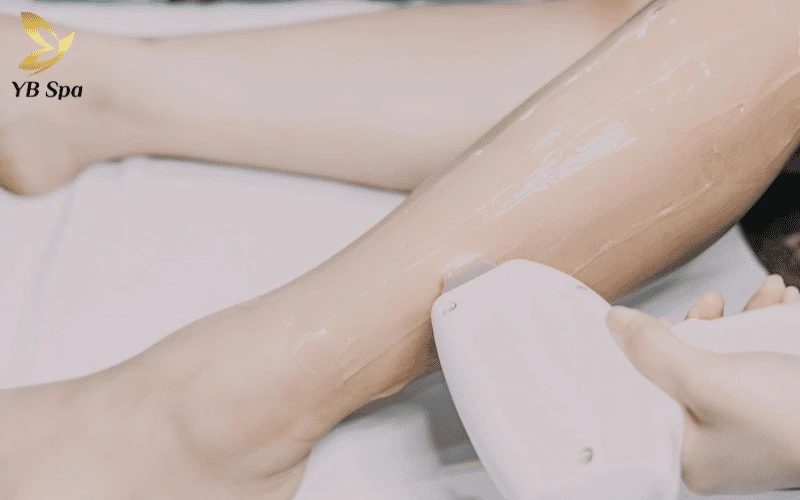 Lam Thanh Spa kết hợp công nghệ triệt lông SHR hiện đại cùng gel dưỡng tự nhiên để mang lại làn da trắng sáng và mịn màng sau liệu trình