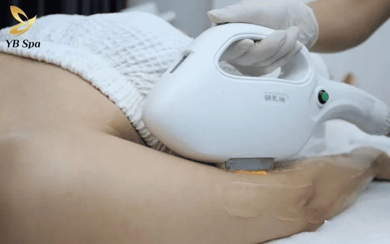 Viện Thẩm Mỹ Quốc Tế Hải Anh ứng dụng Diode Laser 808nm - "tiêu chuẩn vàng" giúp triệt lông tận gốc và bảo vệ tối đa các mô da xung quanh