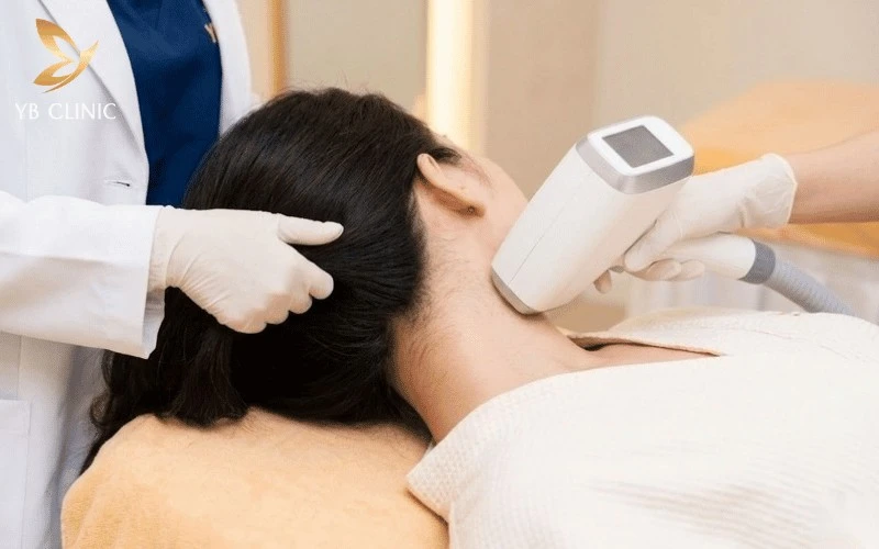 Triệt Lông Gáy Là Gì? Triệt Lông Gáy Có Tốt Không? 9 Triệt gáy tại YB Clinic giúp làm sạch vùng chân tóc gáy, mang lại đường viền tóc gọn gàng, tự tin hơn với công nghệ Nano Diamond Light hiện đại.