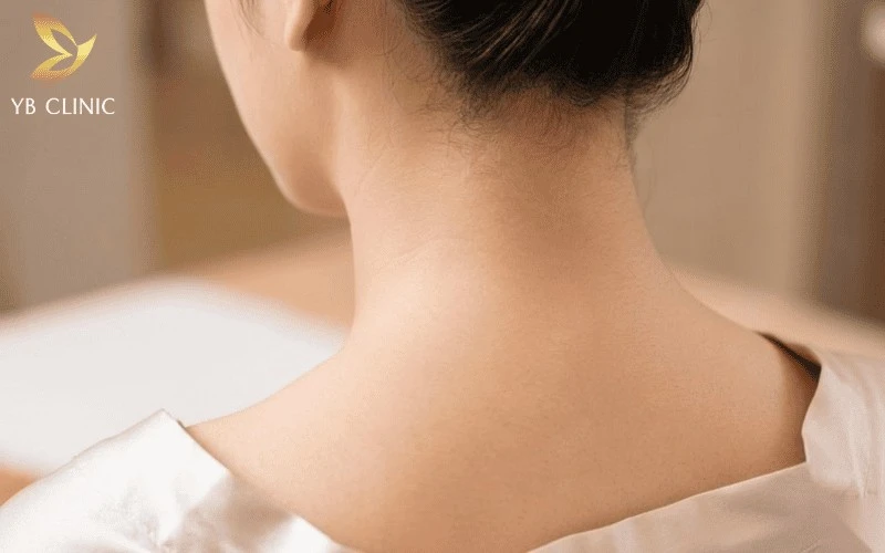 Triệt Lông Gáy Là Gì? Triệt Lông Gáy Có Tốt Không? 13 Người muốn duy trì vùng gáy sạch đẹp lâu dài nên triệt lông gáy để giảm nhu cầu dọn lông thường xuyên, giúp vùng cổ sau luôn mịn màng và thẩm mỹ hơn.